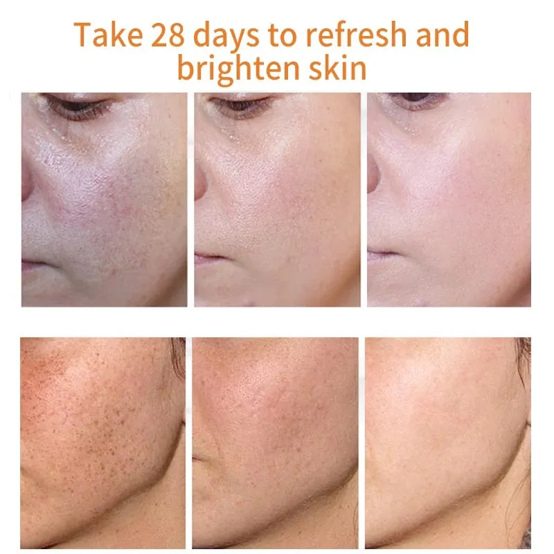 20g Niacinamide Whitening Cream