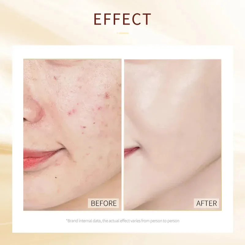 30 Piece Moisturizing Anti Aging Face Mask For Beauty