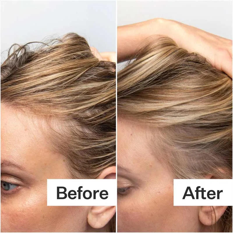 Act Acre Oily Scalp System