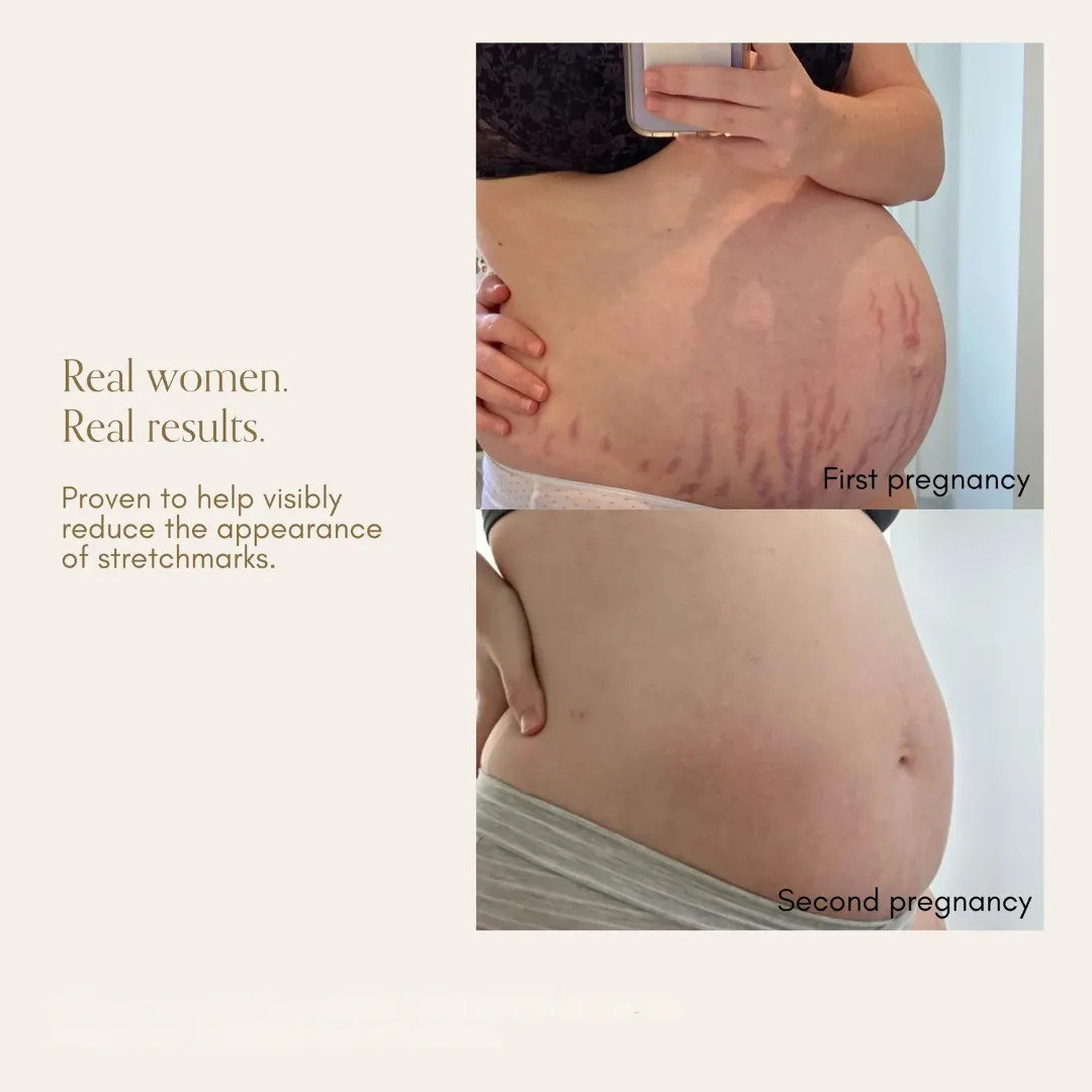 Bump Love Set by Pure Mama