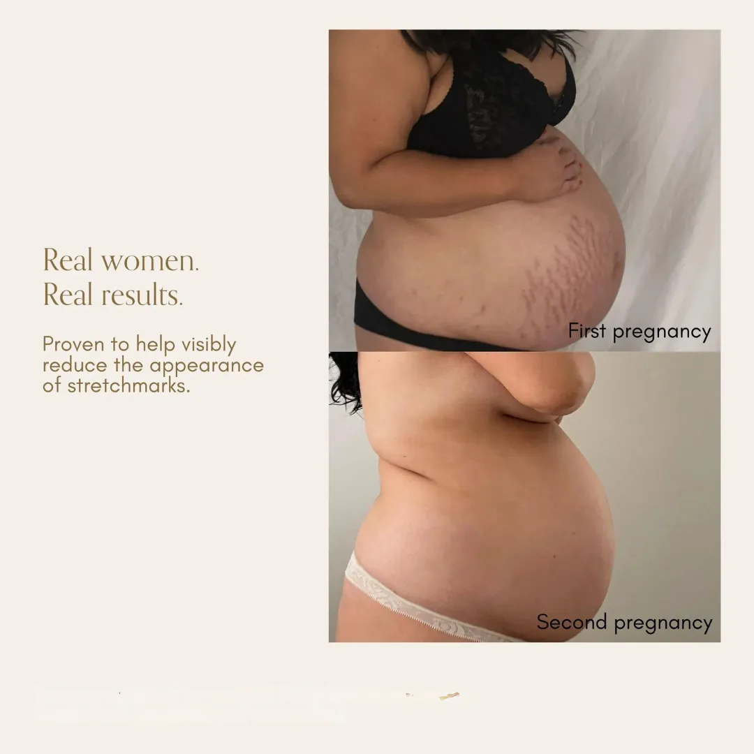 Bump Love Set by Pure Mama