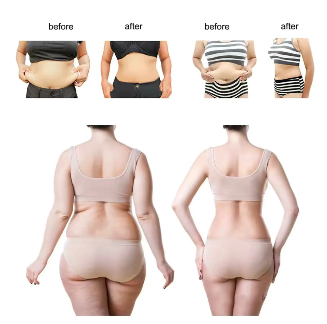 Clinical Strength Anti Cellulite Body Slimming Fat Loss Cream- Best Seller!
