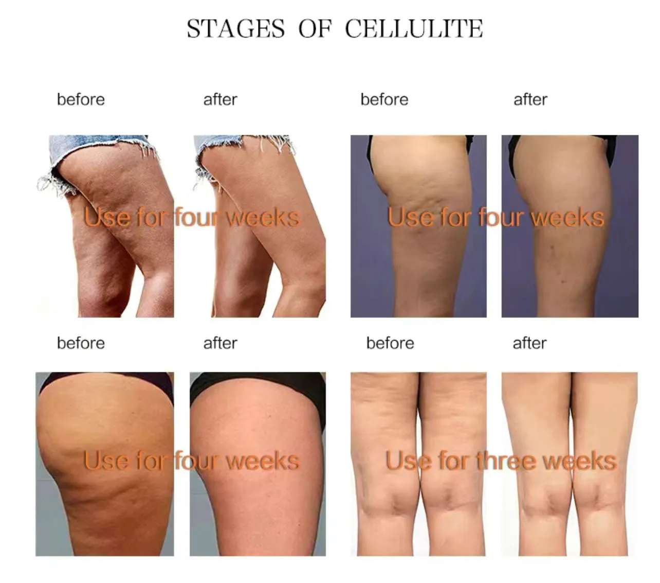 Clinical Strength Anti Cellulite Body Slimming Fat Loss Cream- Best Seller!