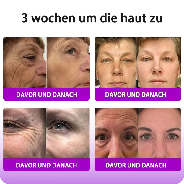 Fubsta Hyaluronsure Age-Defy CremeLetzter Tag Rabatt: 70% OFF