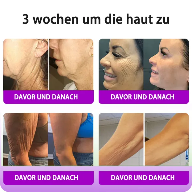 Fubsta Hyaluronsure Age-Defy CremeLetzter Tag Rabatt: 70% OFF