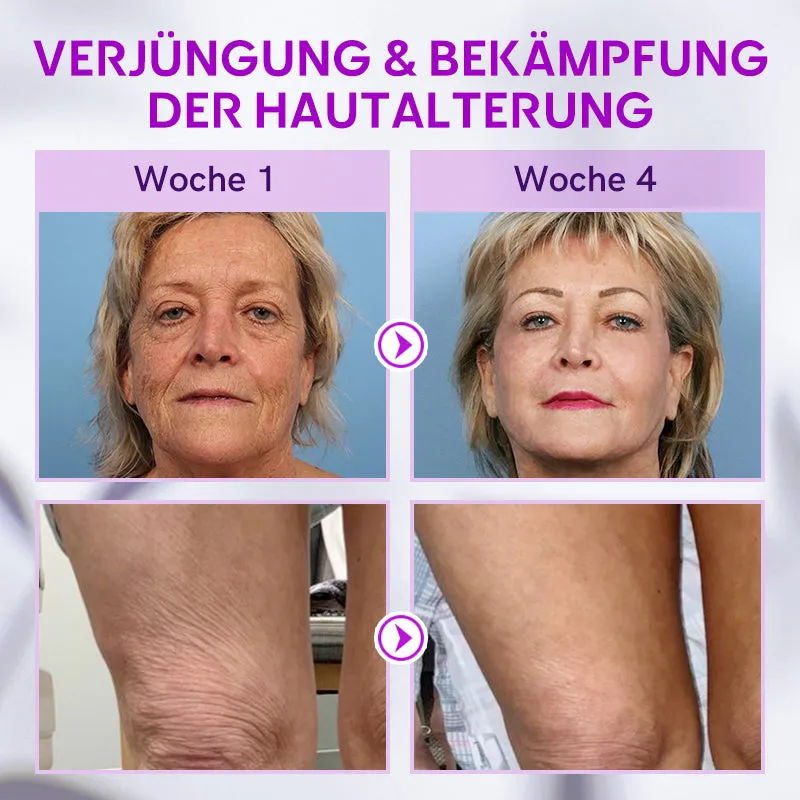 Fubsta Hyaluronsure Age-Defy CremeLetzter Tag Rabatt: 70% OFF