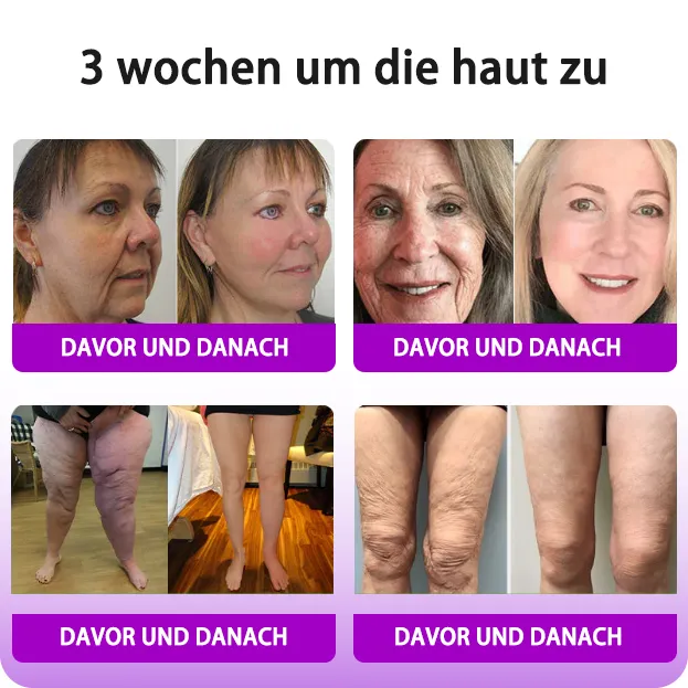 Fubsta Hyaluronsure Age-Defy CremeLetzter Tag Rabatt: 70% OFF