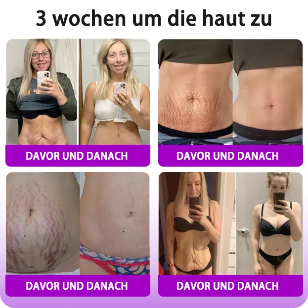 Fubsta Hyaluronsure Age-Defy CremeLetzter Tag Rabatt: 70% OFF