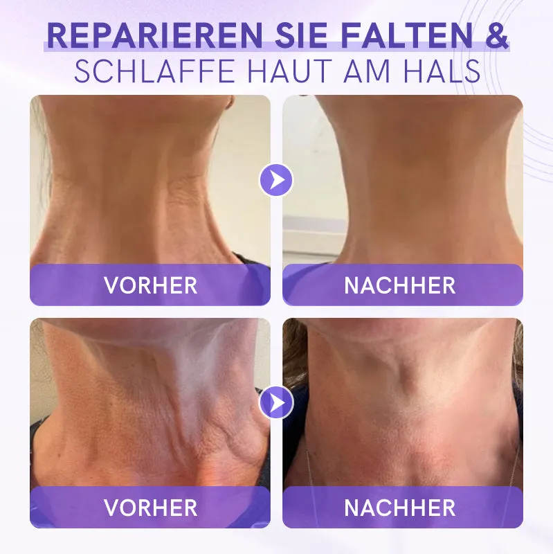 Furzero Deutsch Straffungs- & Lifting-HalscremeLetzter Tag Rabatt: 75% OFF