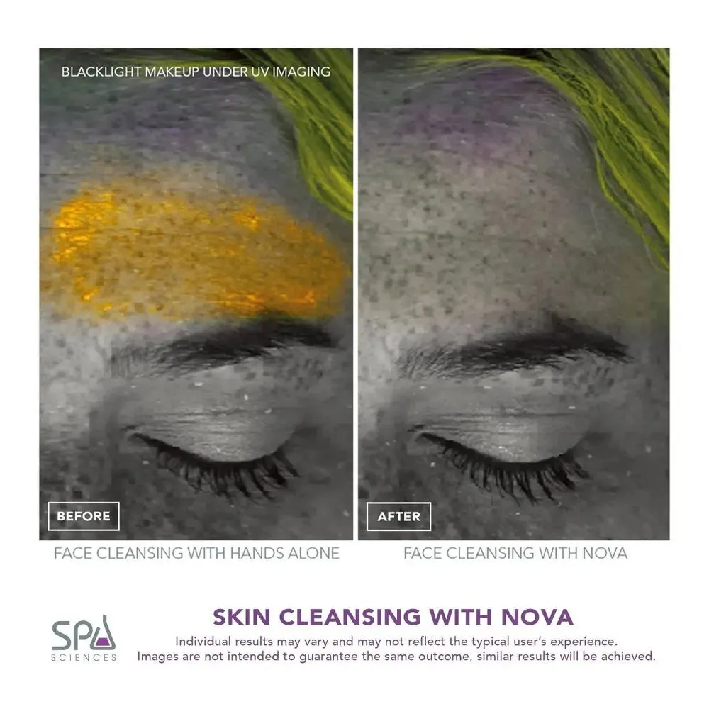 New - Spa Sciences Nova Antimicrobial Sonic Cleansing Brush & Infusion System - Mint