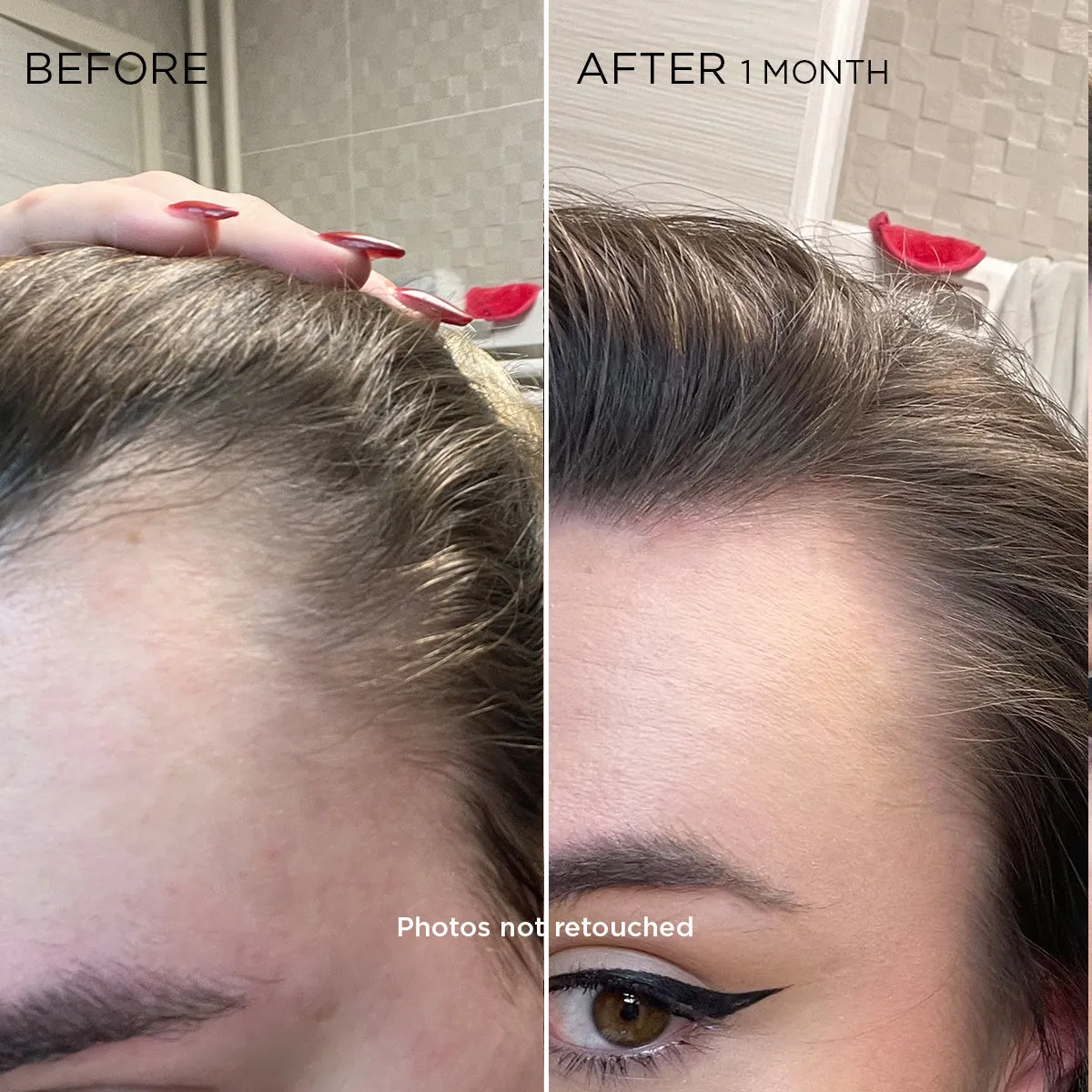 PHYTOCYANE Revitalizing Treatment for Reactional Hair Thinning - Women
