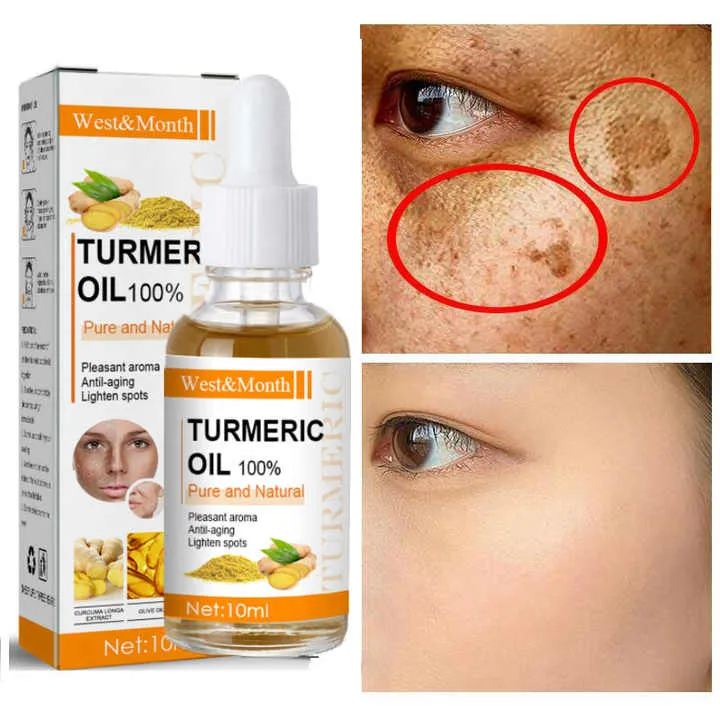 Remove Dark Spots Turmeric Essential -إزالة البقع الداكنة،