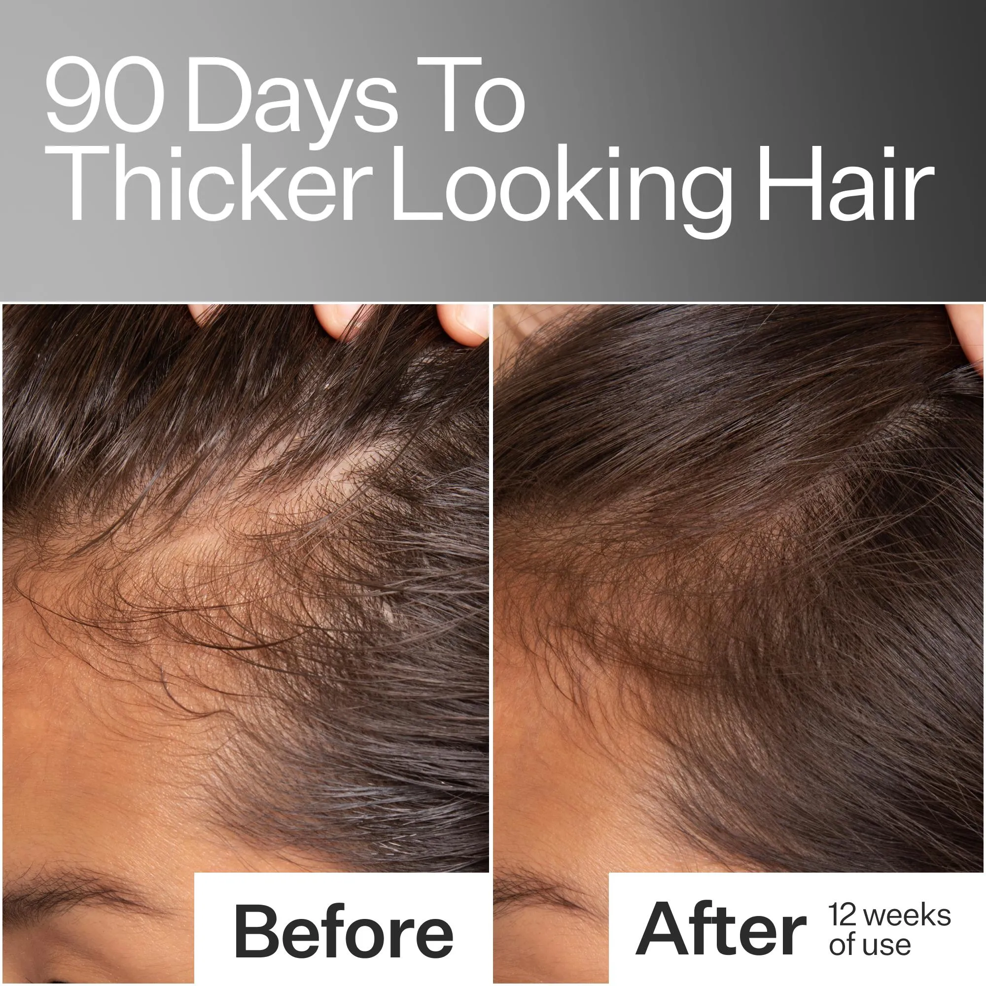 Stem Cell Scalp Serum