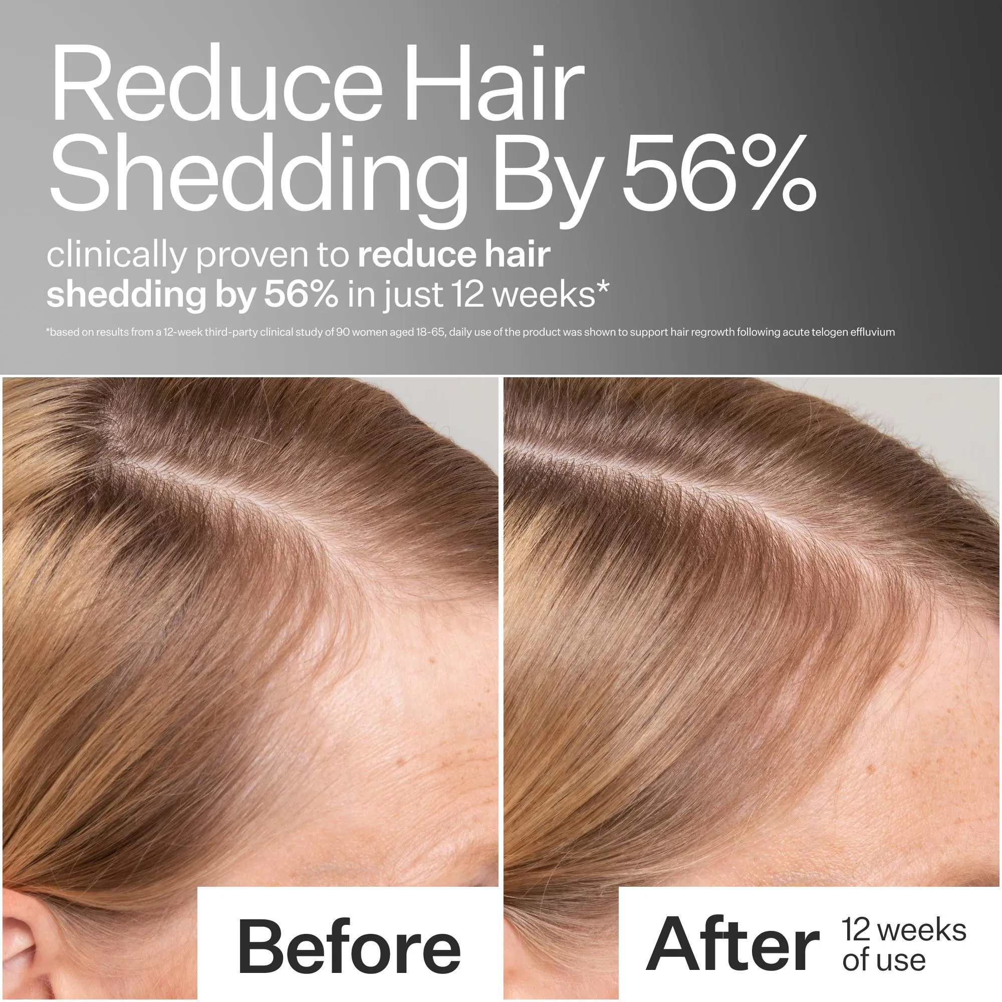 Stem Cell Scalp Serum