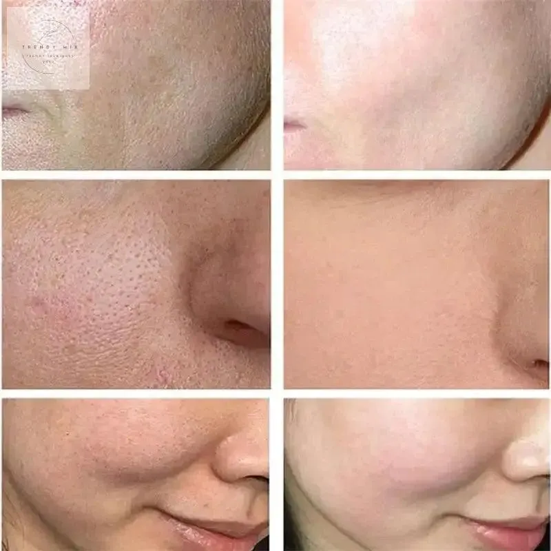 Wrinkle Remover Face Serum: Anti-aging, Whitening